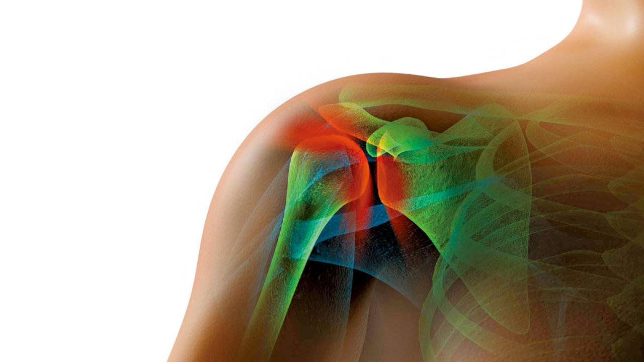 從五十肩聯想起中年失業