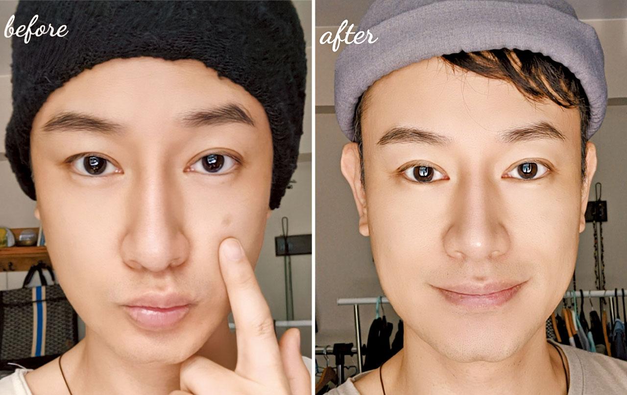 黑斑請你遠離我！