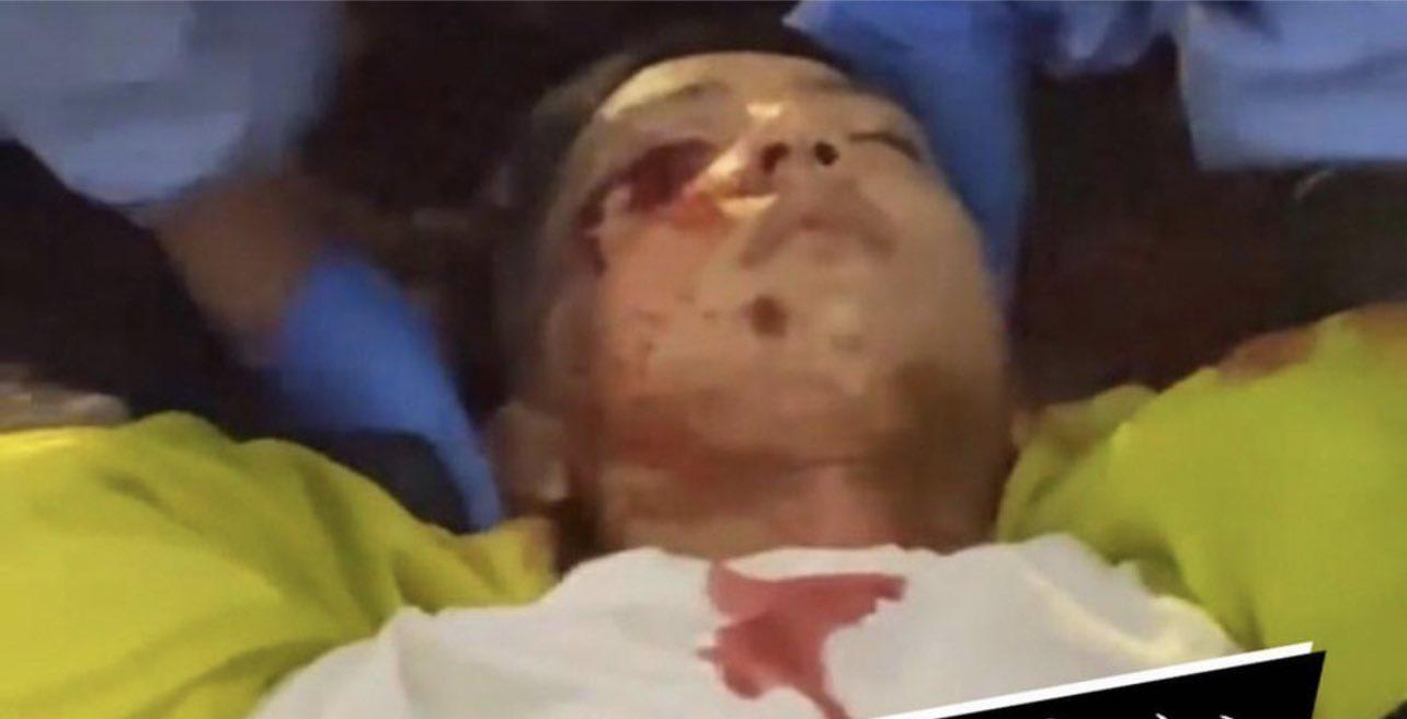 日本沖繩縣警方就年初的衝突調查，在涉事警員的警棍驗出有受傷學生的基因。(網上圖片)