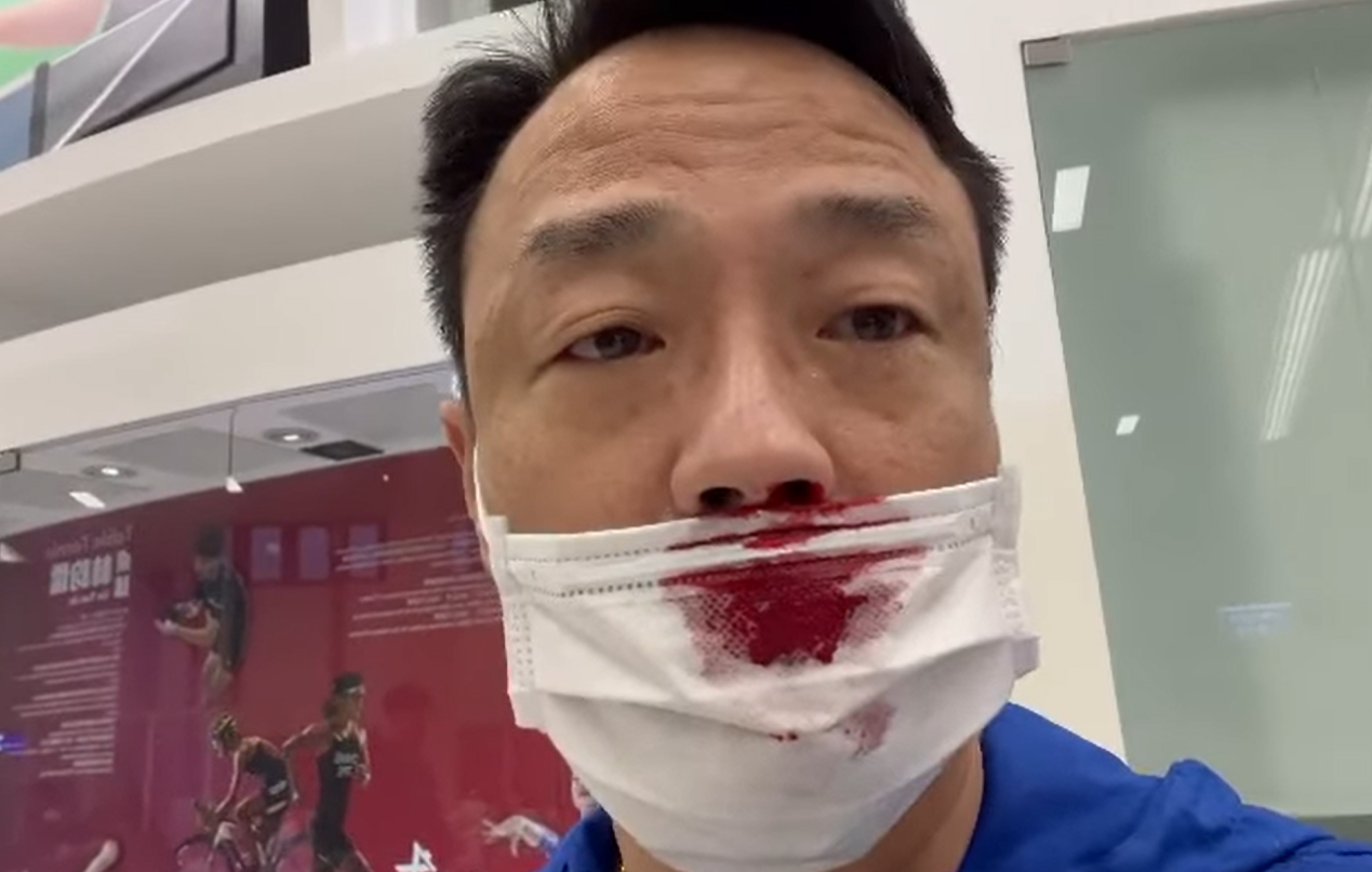 王喜去年底移居台灣 入境做PCR被撩到流鼻血