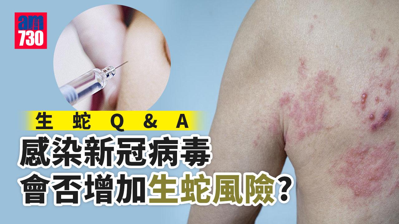 生蛇疫苗｜80歲打針都有九成保護力