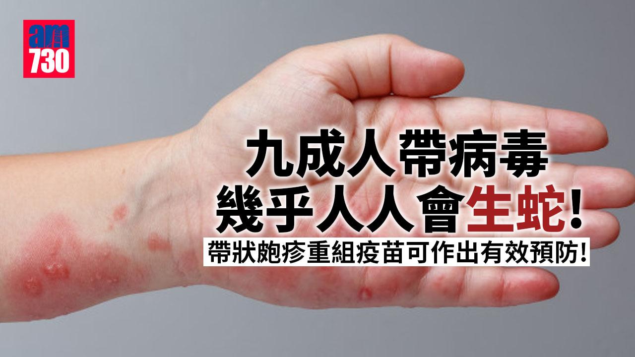 預防生蛇 免後遺症