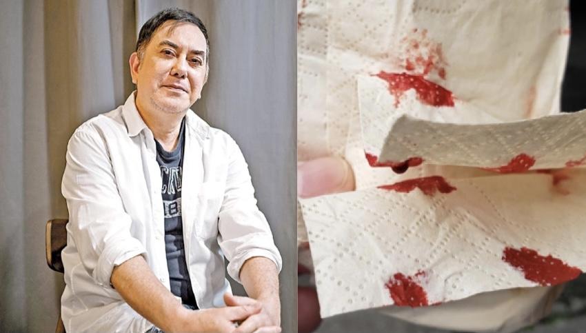 黃秋生台灣做檢測流鼻血掀網民罵戰  咪嘈交，笑下就算