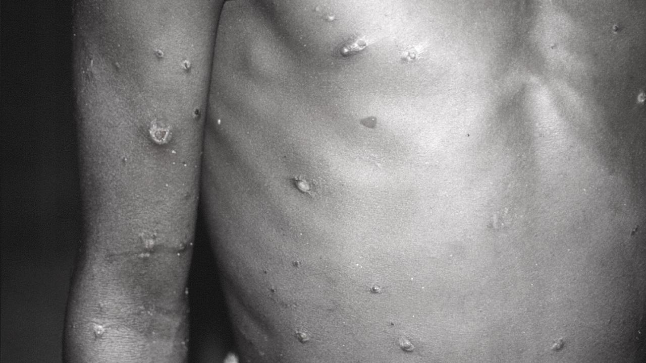 世衛：對全球公共衞生構成中度風險。(資料圖片)