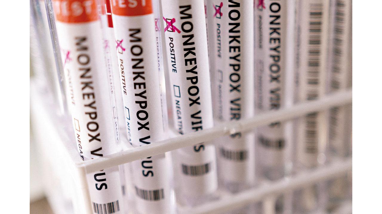 歐洲爆發｜捷克斯洛文尼首確診 英國單日增37宗猴痘