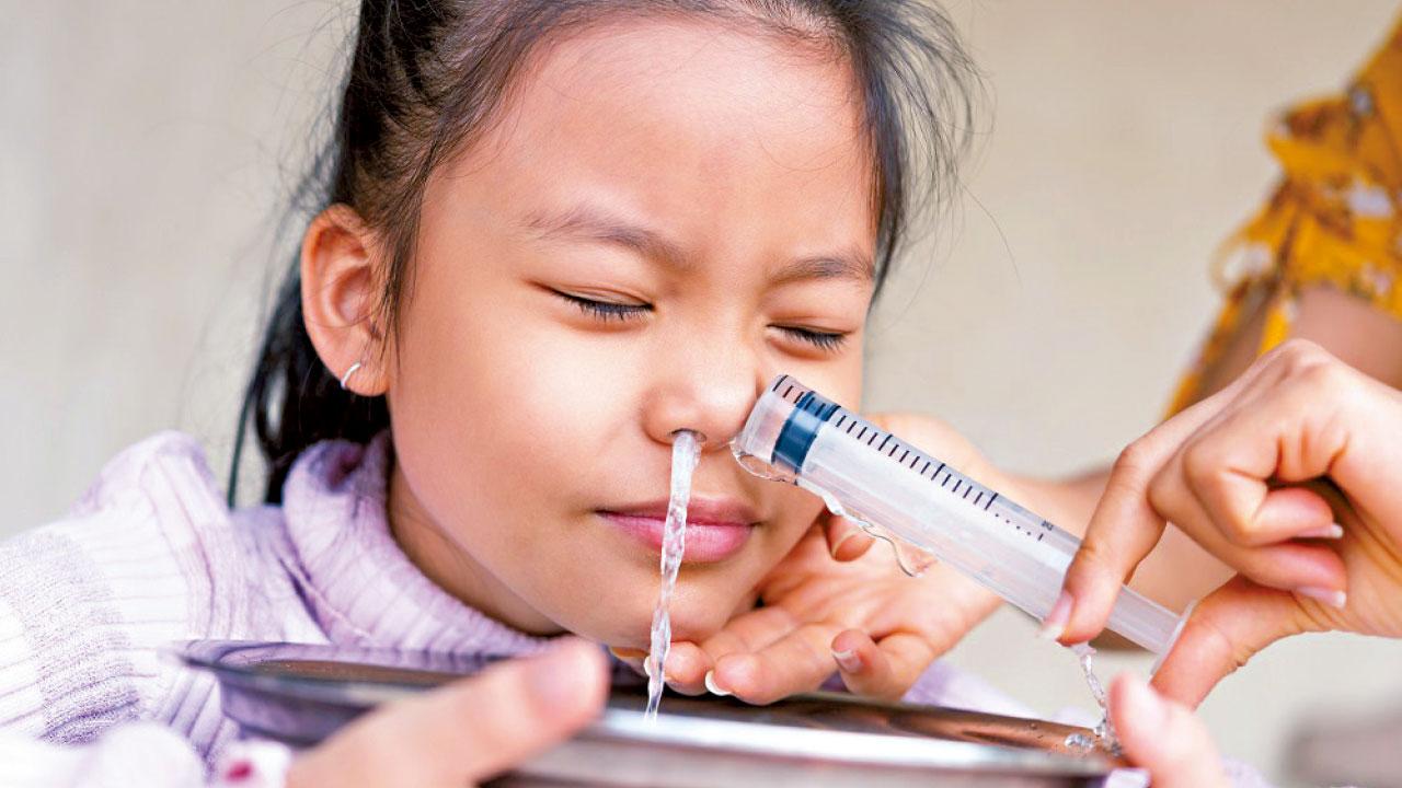 可大可小｜擠爆鼻內膿瘡致顱內感染 深圳愛撩鼻少女險死