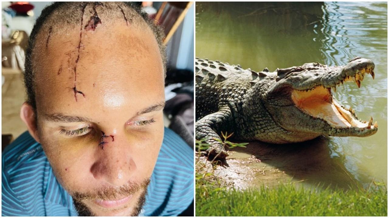 遭鱷魚咬頭兼「死亡翻滾」，男子險失血過多致死。(網上圖片)