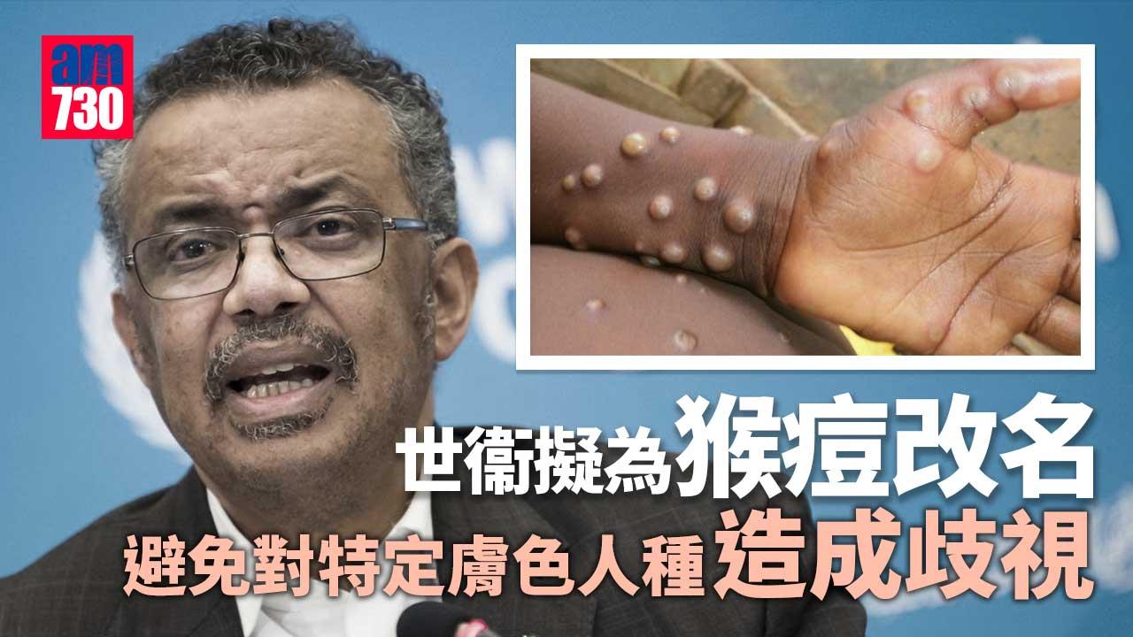猴痘｜世衞下周評估是否構成突發公共衞生事件　另擬為猴痘改名