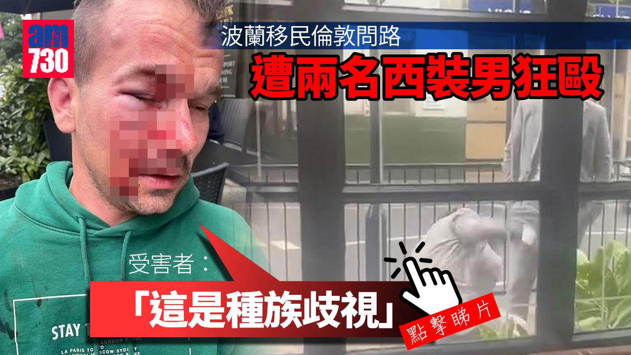 倫敦駭人種族仇恨襲擊 波蘭移民問路遭狂毆血流披面