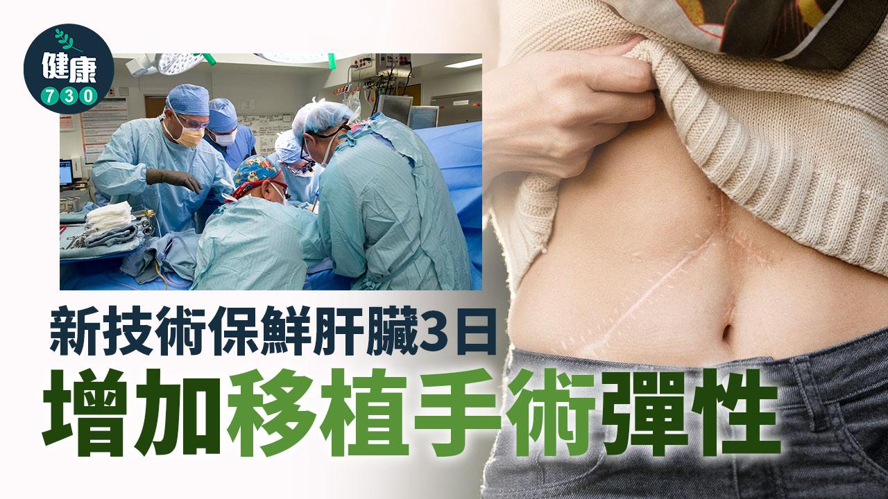新技術保鮮肝臟3日 增加移植手術彈性