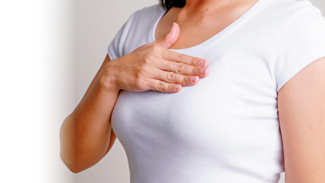 半數女性會患乳房良性腫瘤？ 