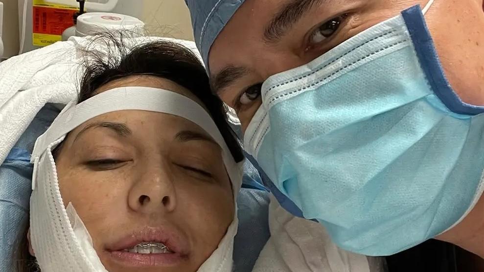 兩孩之母產後身材走樣 整形老公親自操刀助回春