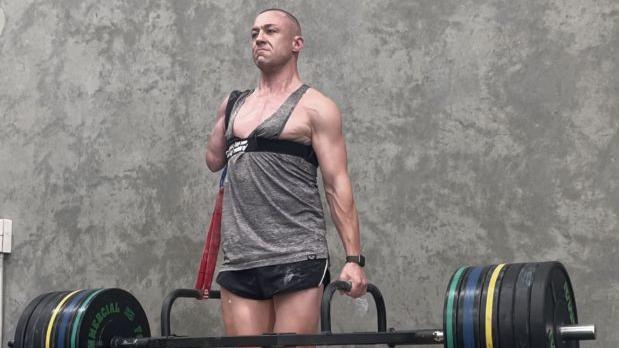 澳男舉50KG啞鈴撕斷手臂  駁回後染食肉菌須截肢保命