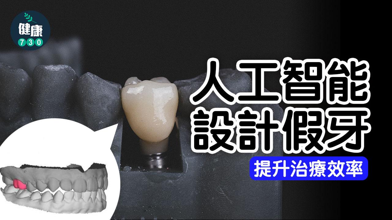 人工智能設計假牙 提升治療效率