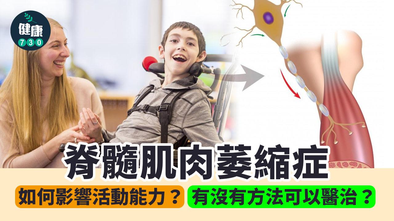 脊髓肌肉萎縮症 如何影響活動能力？