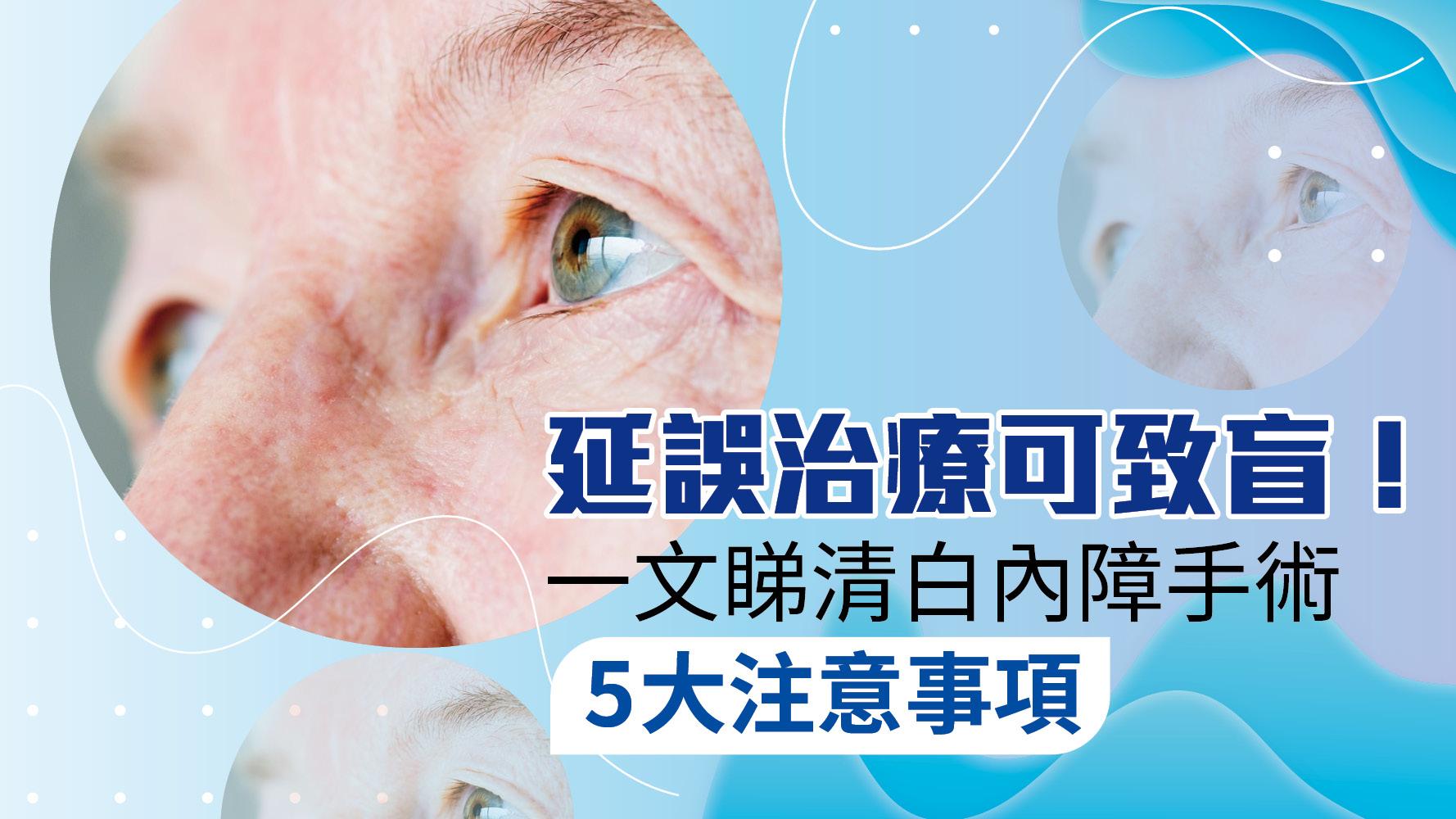 延誤治療可致盲！一文睇清白內障手術5大注意事項