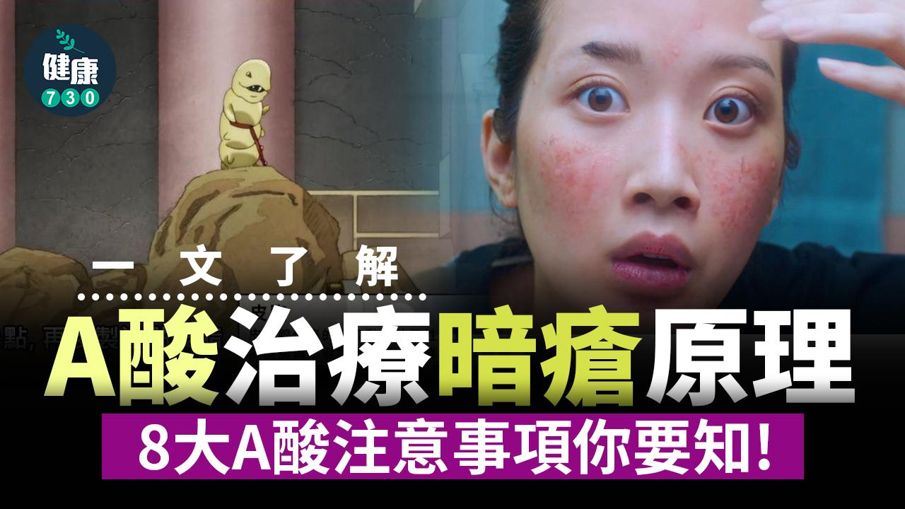 一文了解A酸治療原理、爆發期及副作用 8大A酸注意事項你要知