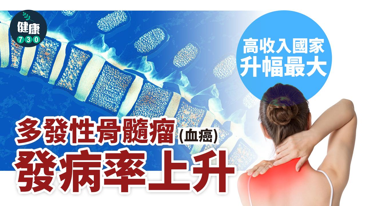 血癌｜多發性骨髓瘤發病率上升 高收入國家升幅最大