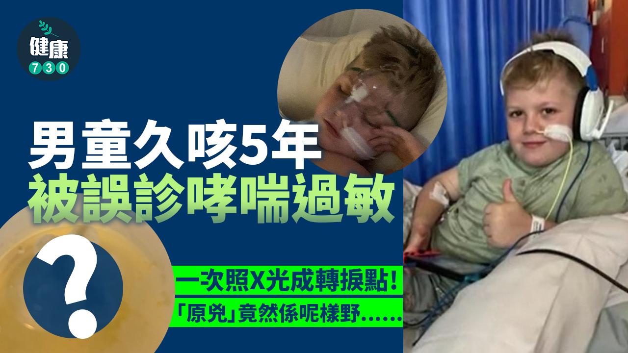 育兒知識｜男童久咳5年被誤診哮喘過敏 「原兇」令人R爆頭