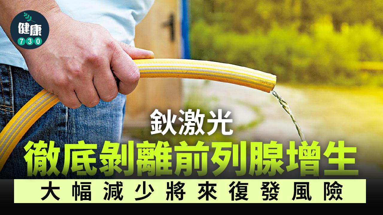 鈥激光 徹底剝離前列腺增生