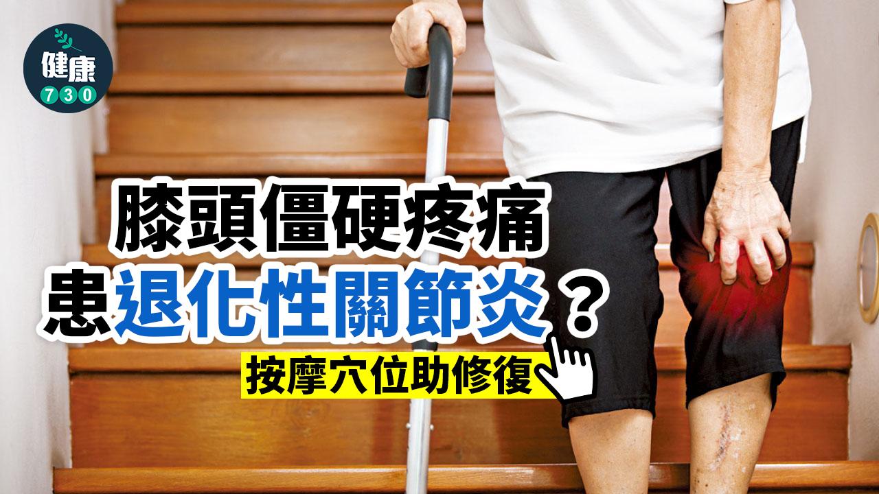 關節炎｜膝頭僵硬疼痛 患退化性關節炎？