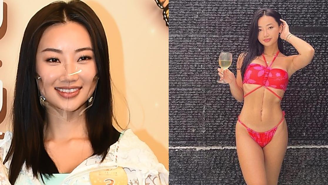 港姐2022｜陳瑞菱胃後有21cm腫瘤 手術後不介意留長疤