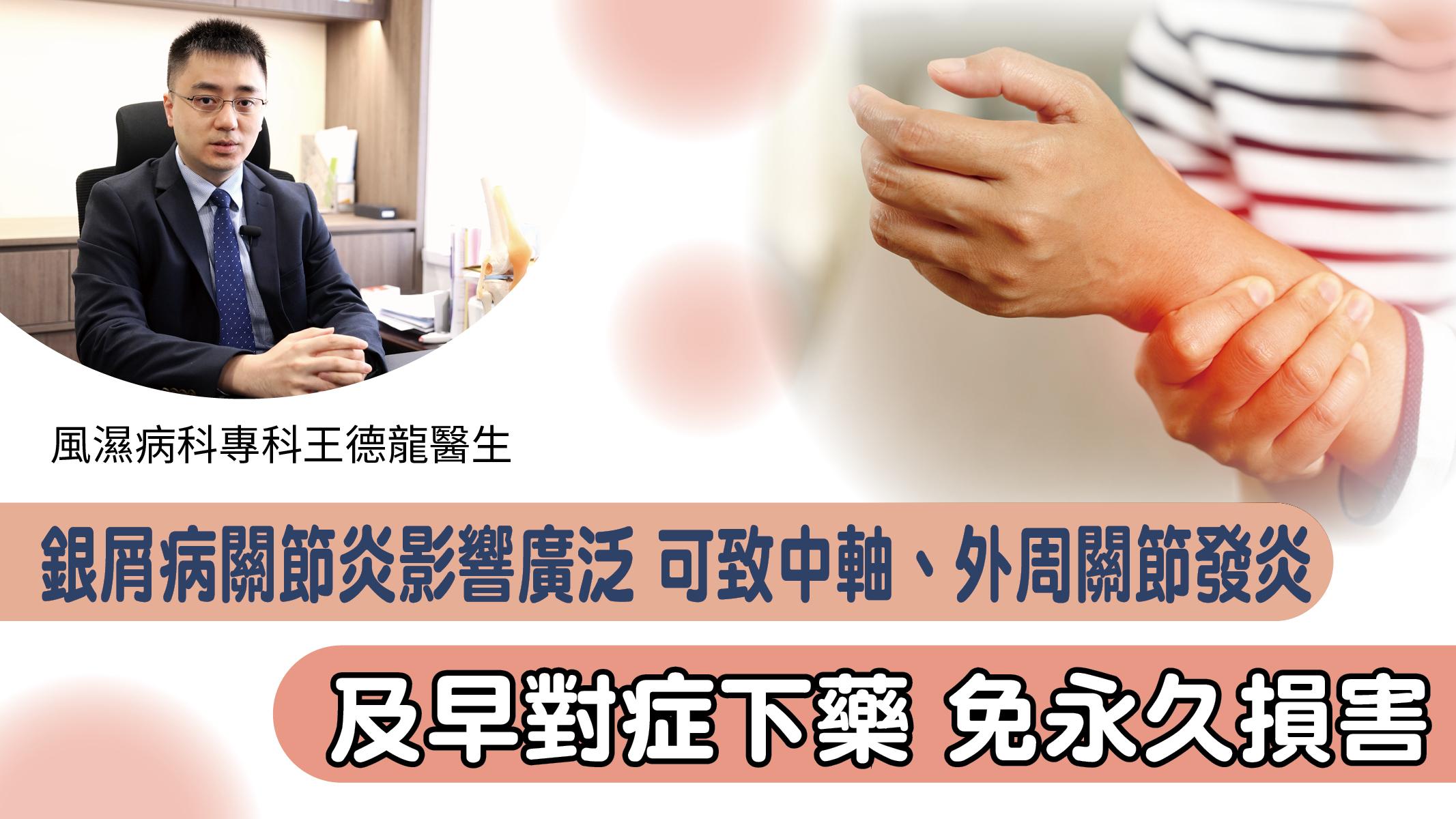 銀屑病關節炎影響廣泛 可致中軸、外周關節發炎 及早對症下藥免永久損害