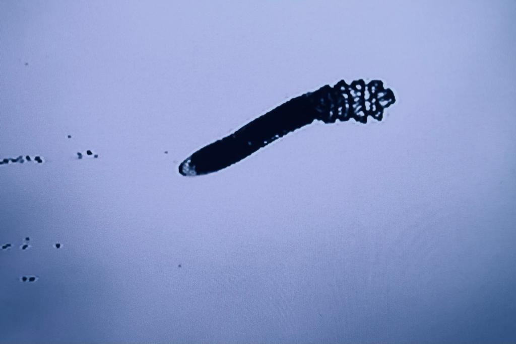 顯微鏡下見到的蟎蟲