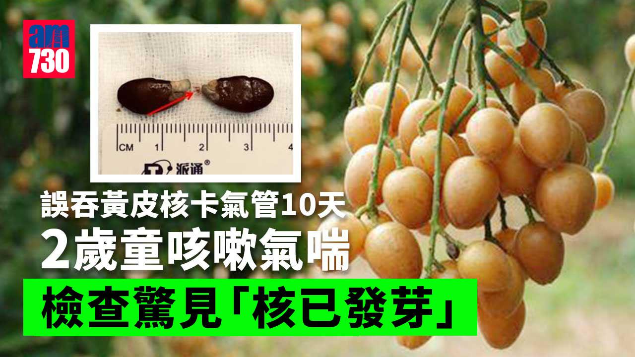 黃皮核卡氣管10天 2歲寶寶咳嗽氣喘 檢查驚見「核已發芽」