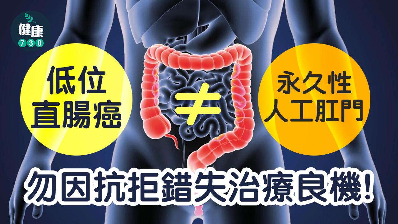 低位直腸癌≠永久性人工肛門 勿因抗拒錯失治療良機！