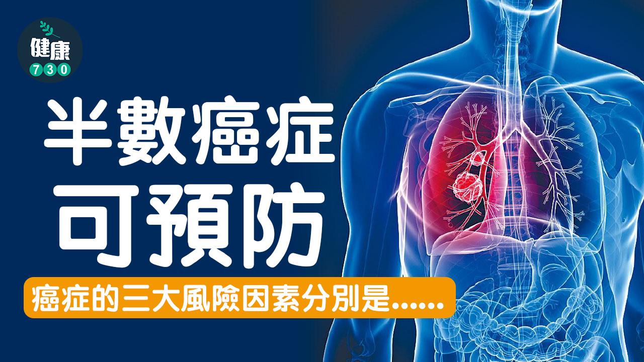 半數癌症可預防 避開3大因素更長壽