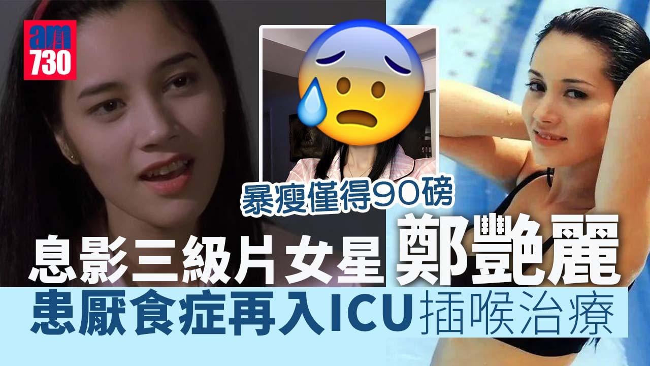 息影三級片女星鄭艷麗 患厭食症激瘦自爆再入ICU