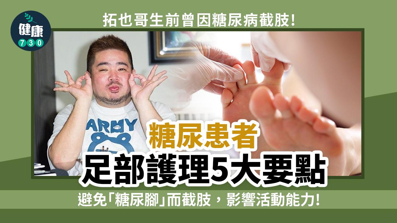拓也哥生前曾因糖尿病截肢 足部護理5大要點