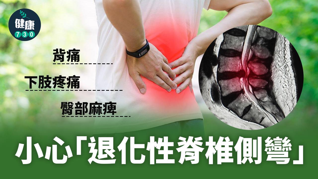 背痛、臀部麻痺 小心「退化性脊椎側彎」上身