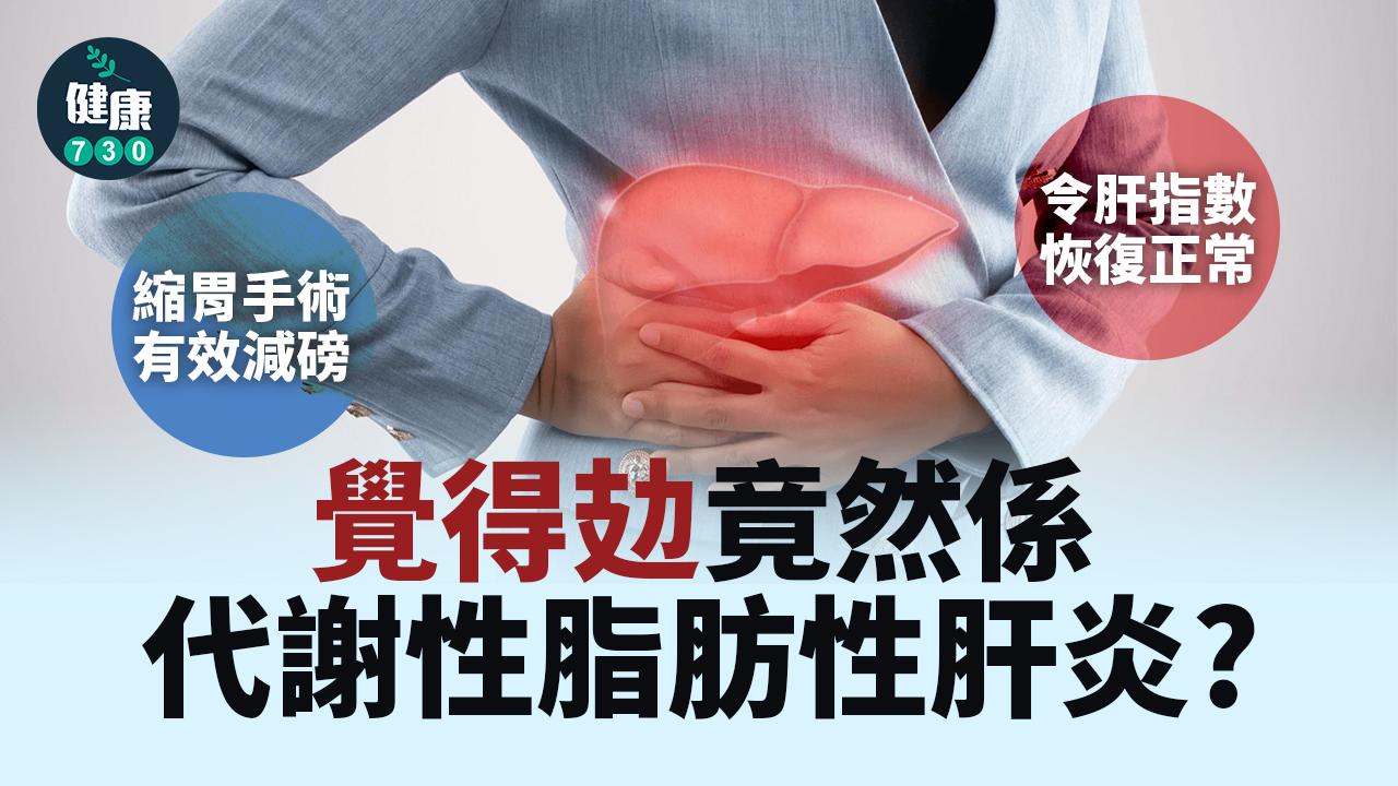 覺得攰竟然係代謝性脂肪性肝炎？內視鏡手術縮胃有效減磅
