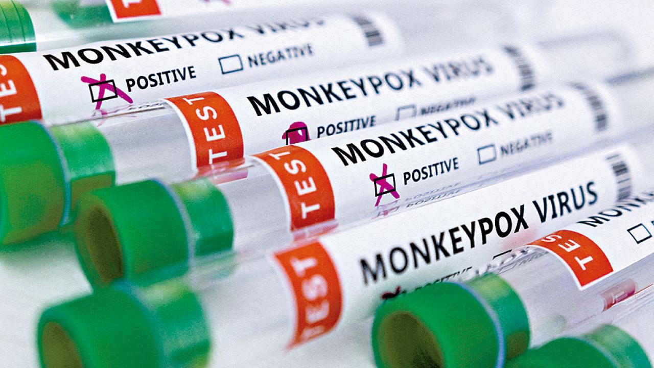 猴痘首闖港 30歲港男疑美感染 曾參與高危活動