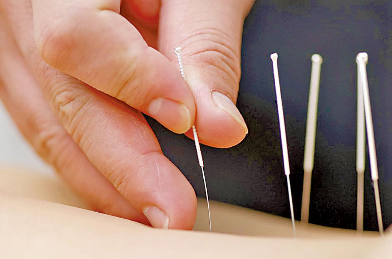 慢性腎功能衰竭針灸療法