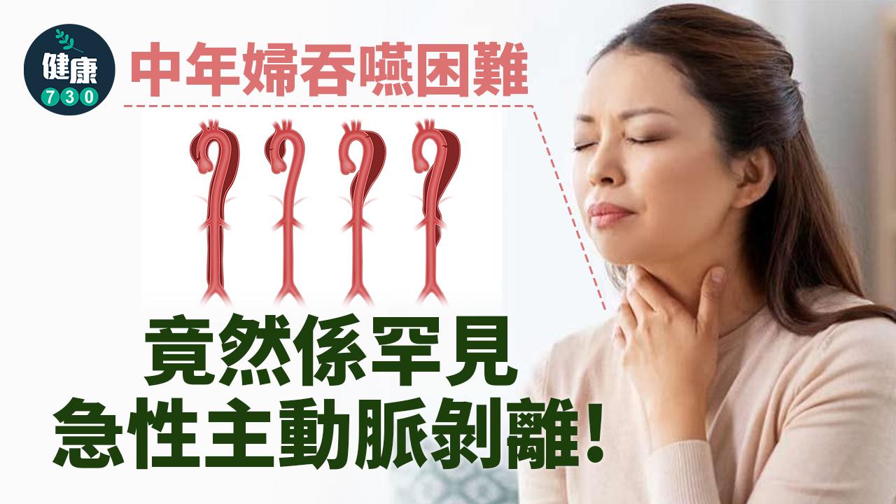 中年婦吞嚥困難 竟然係罕見急性主動脈剝離