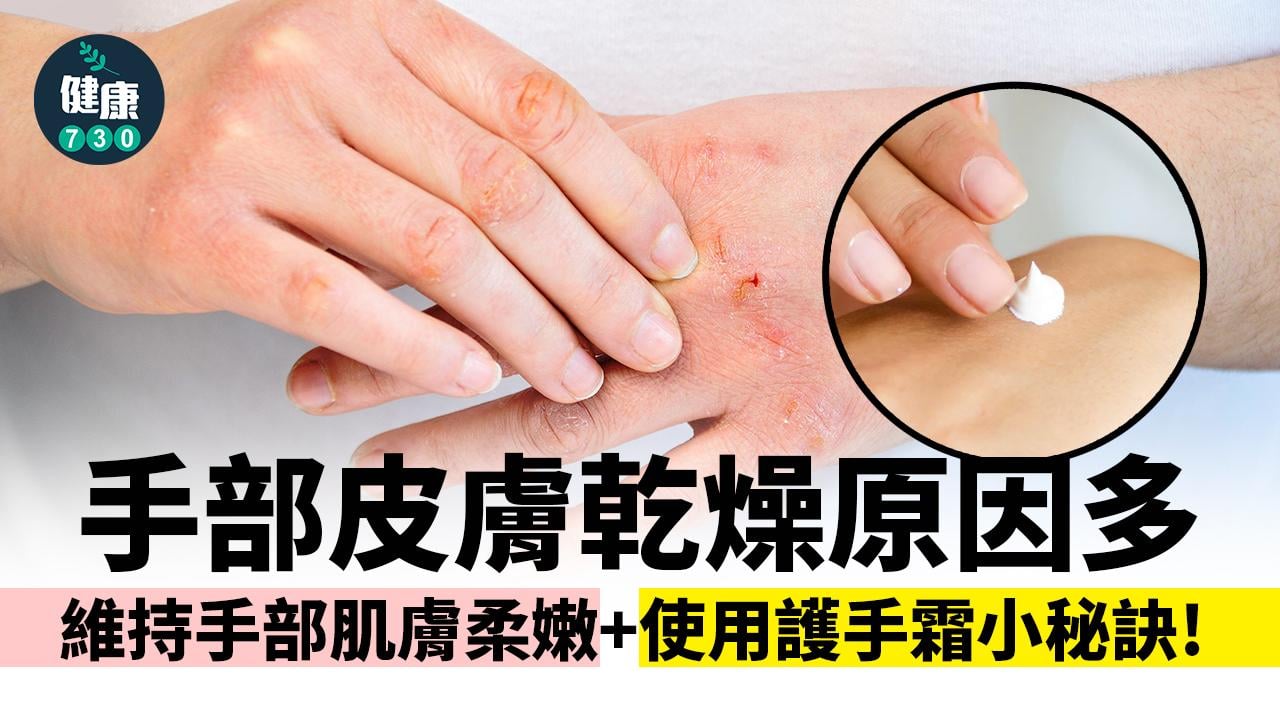 壞習慣令雙手粗糙！使用護手霜兩秘訣