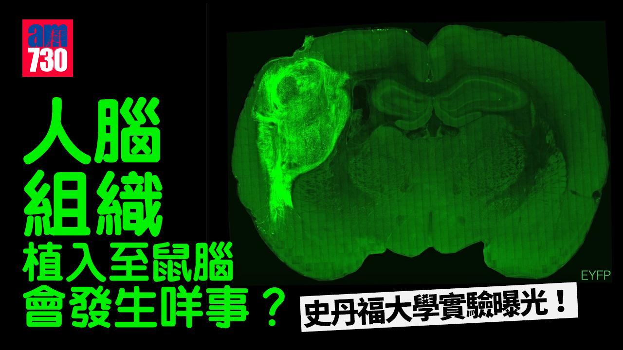人腦組織植入至鼠腦 會發生咩事？史丹福大學實驗曝光