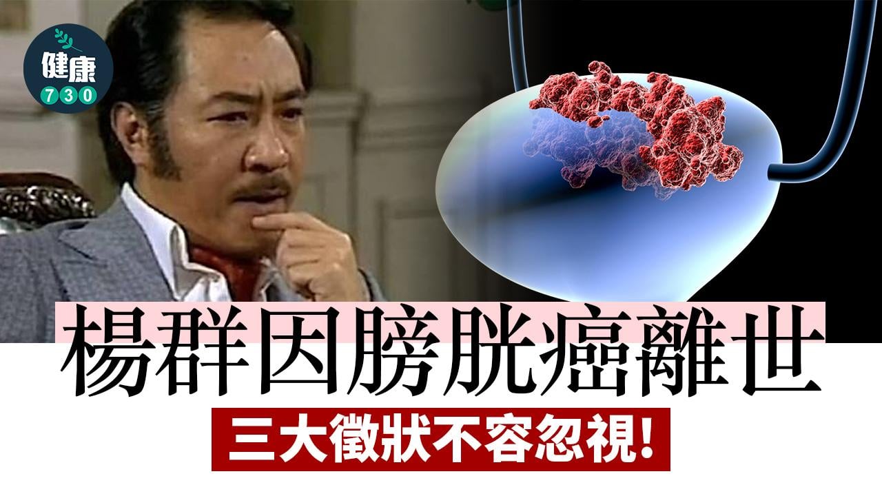 楊群因膀胱癌離世 留意三大徵狀及早求醫