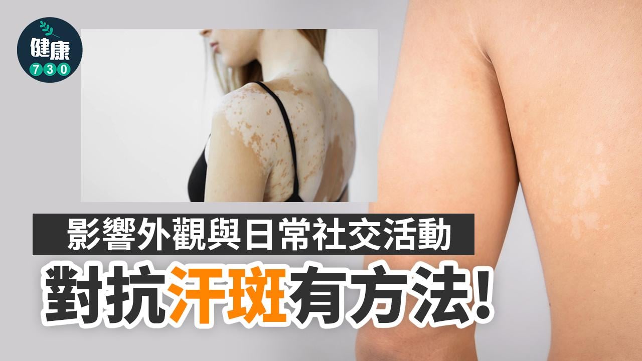 汗斑會傳染？皮膚科醫生教你避免復發