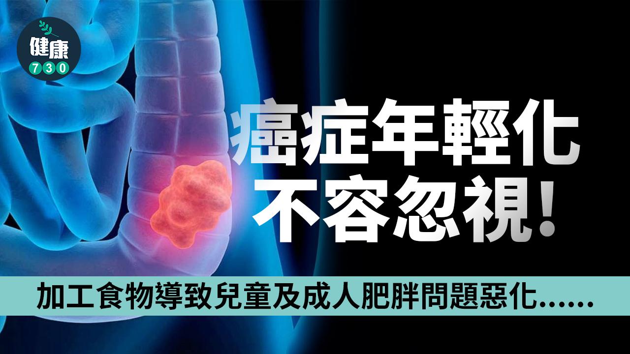 癌症年輕化不容忽視 健康生活助降風險