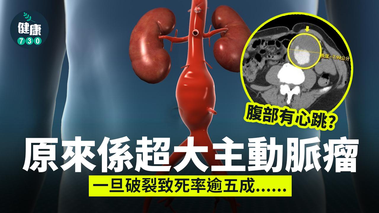 腹部有心跳？原來係超大主動脈瘤 植入支架傷口細過1cm 