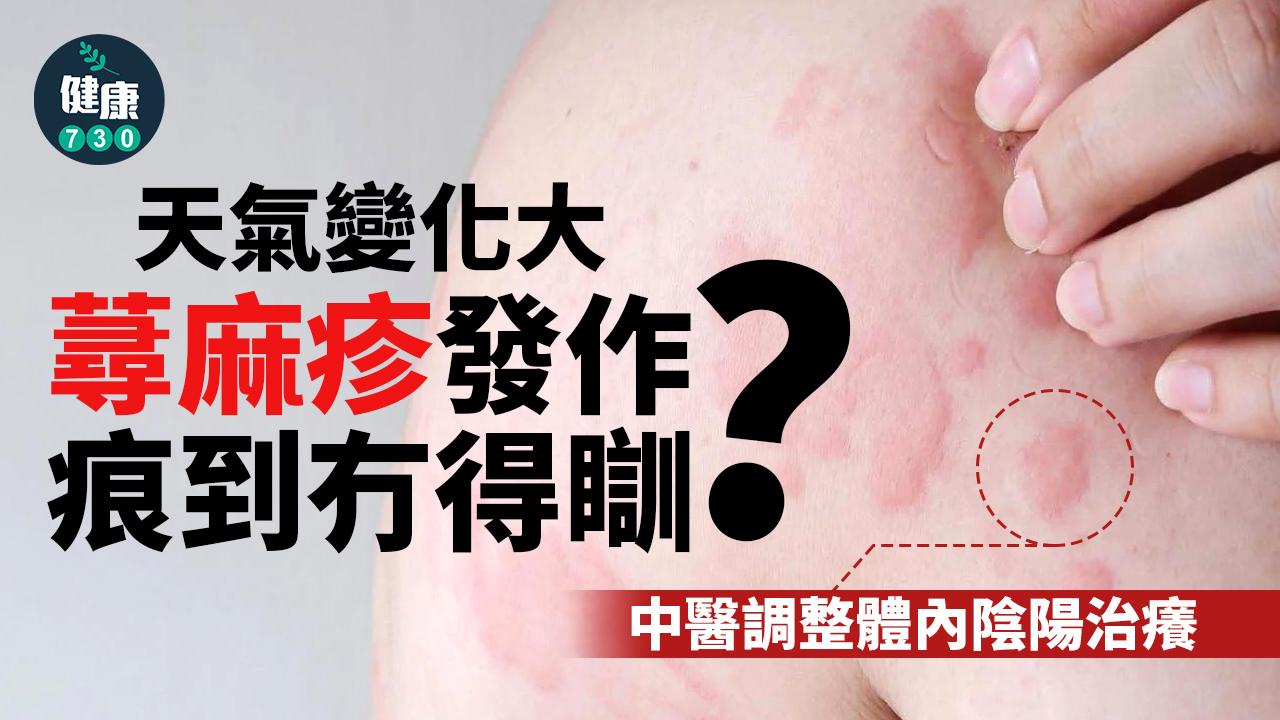 蕁麻疹發作痕到冇得瞓 中醫調整體內陰陽治癢