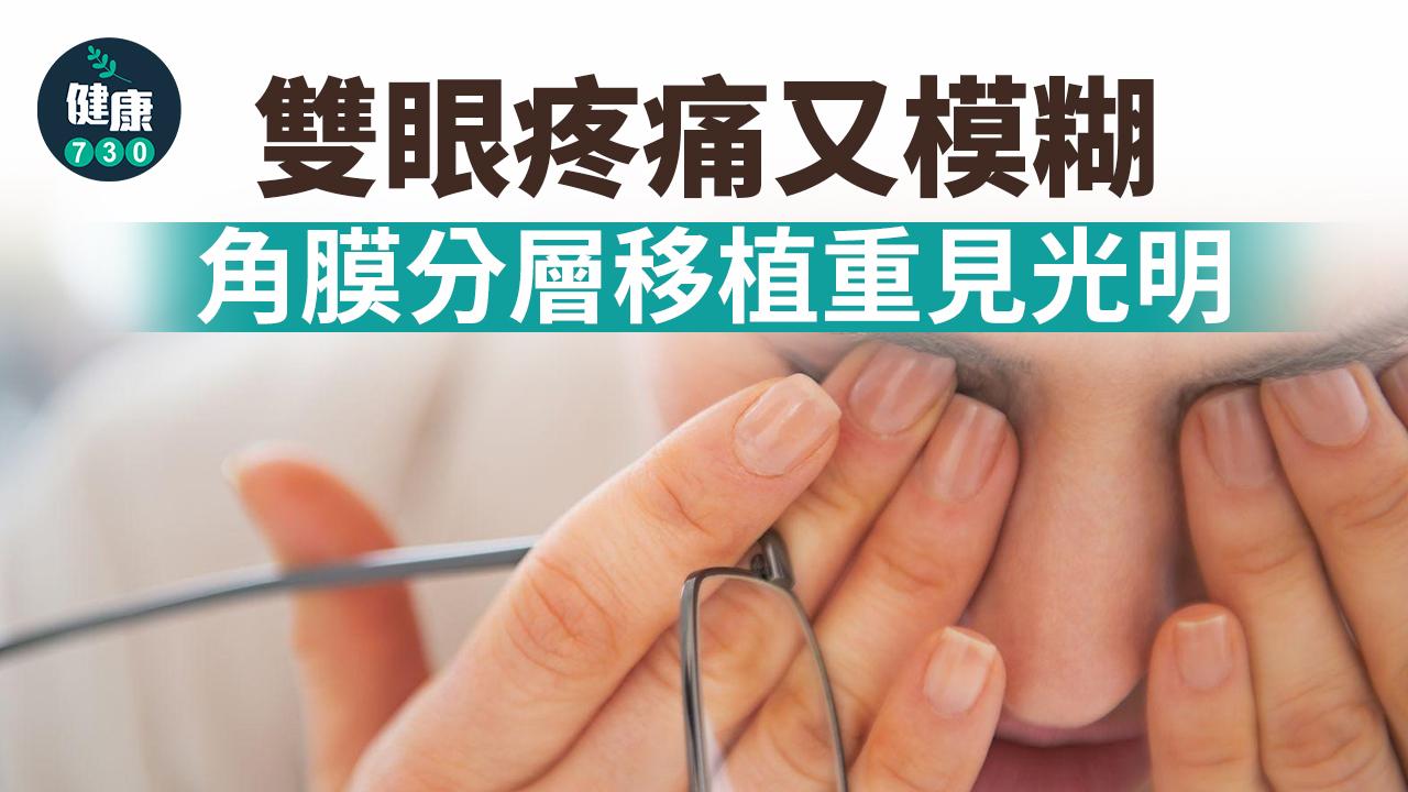 雙眼疼痛又模糊 角膜分層移植重見光明