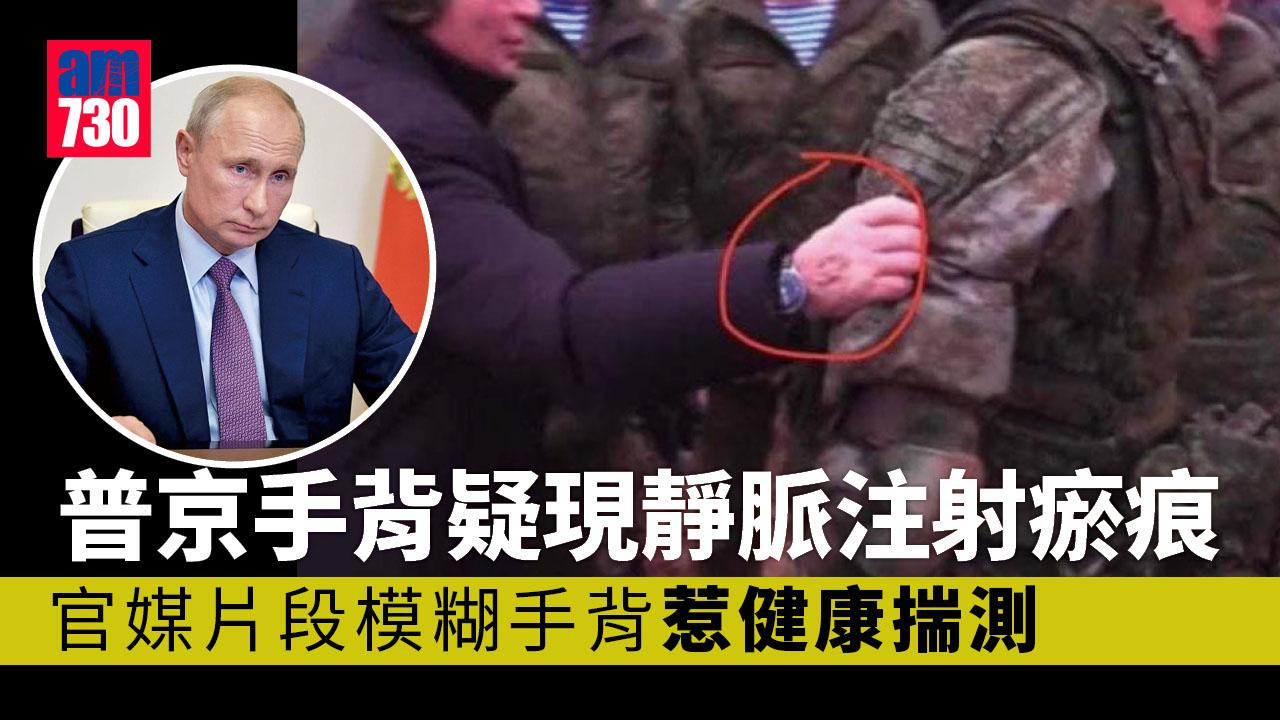 普京手背疑現靜脈注射瘀痕 官媒刪片後加水印兼模糊可疑位置 再惹健康揣測(有片)