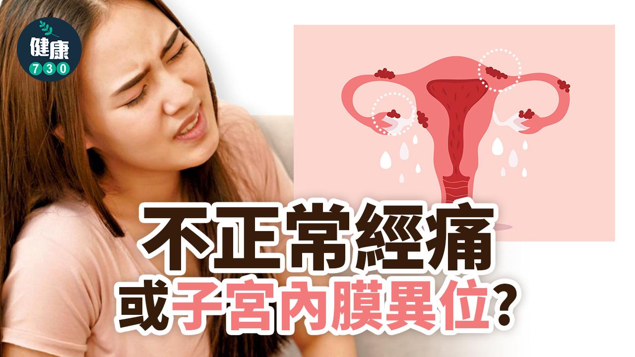 不正常經痛 或子宮內膜異位？