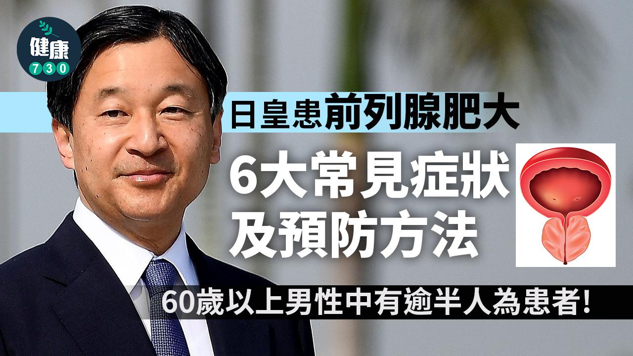 前列腺問題｜日皇患前列腺肥大 留心6大常見症狀