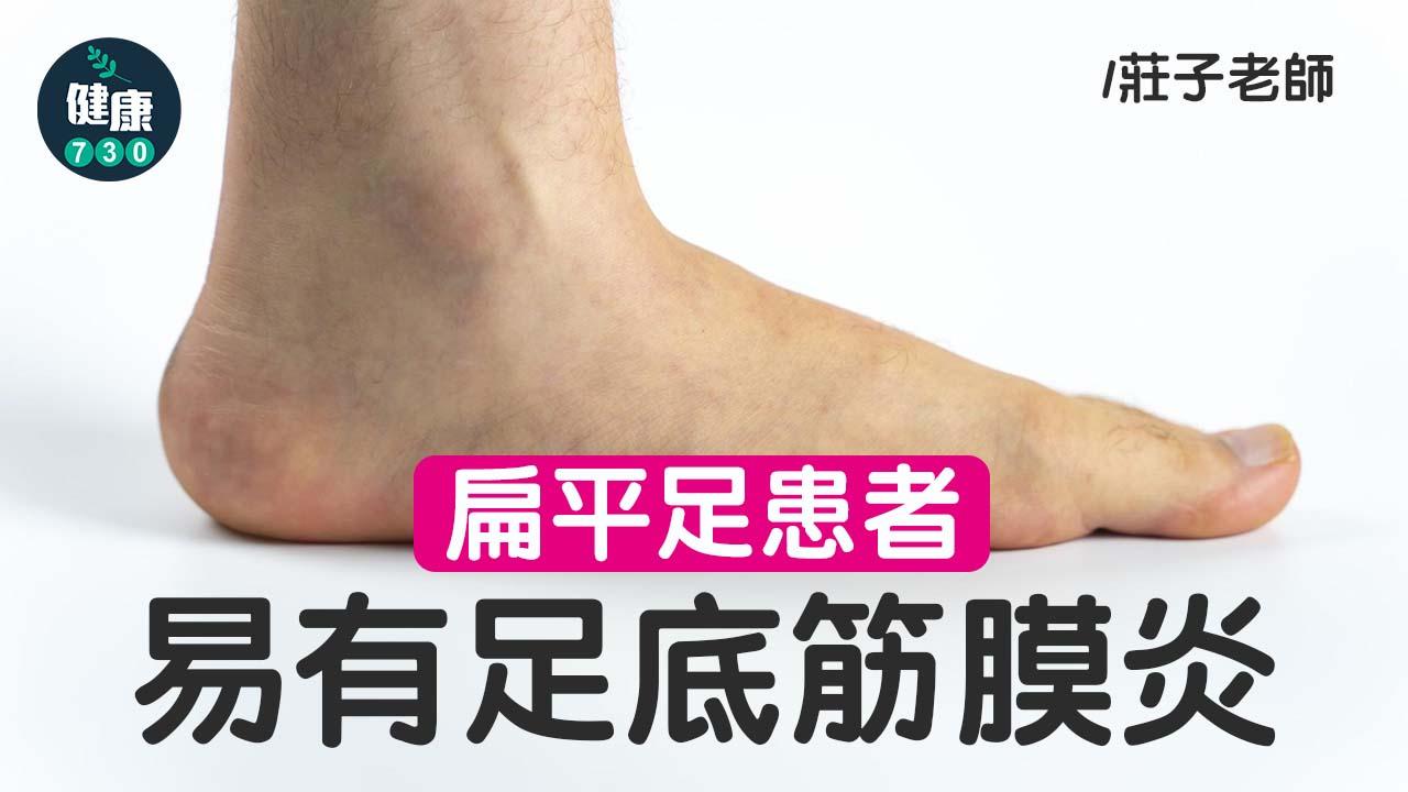 扁平足患者易有足底筋膜炎